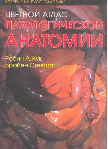 Цветной атлас   Патологической анатомии