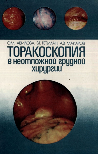 Топароскопия в неотложной грудной хирургии