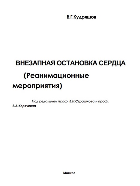 Внезапная остановка сердца