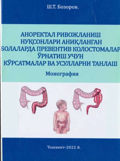 Аноректал ривожланиш нуқсонлари аниқланган болаларда превентив колостомалар ўрнатиш учун кўрсамалар ва усулларни танлаш