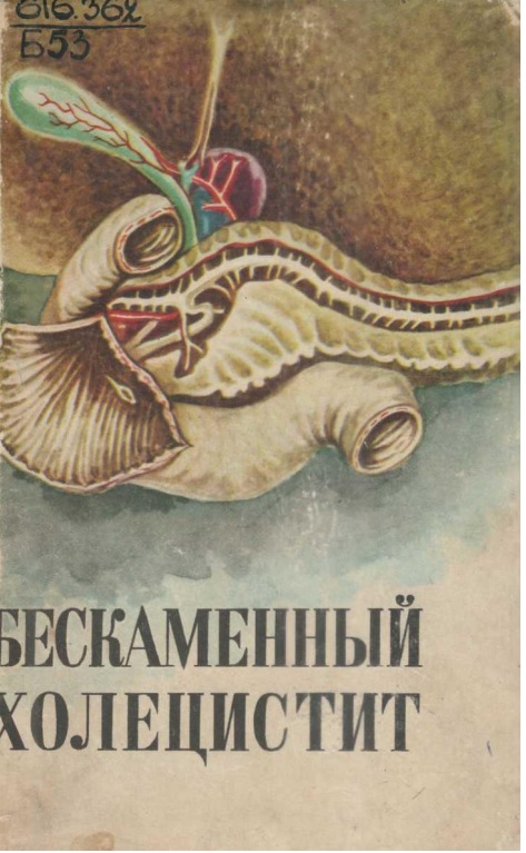 Бескаменный холецистит