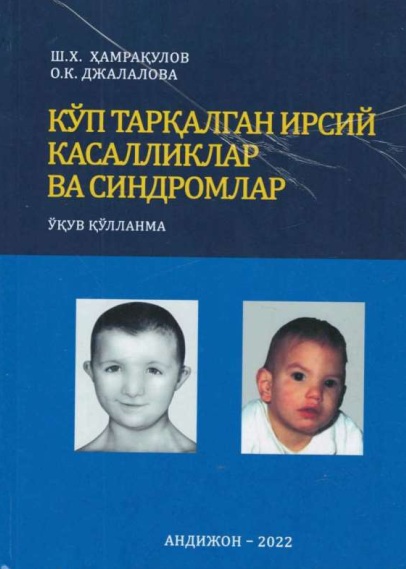 Кўп тарқалган ирсий касалликлар ва синдромлар
