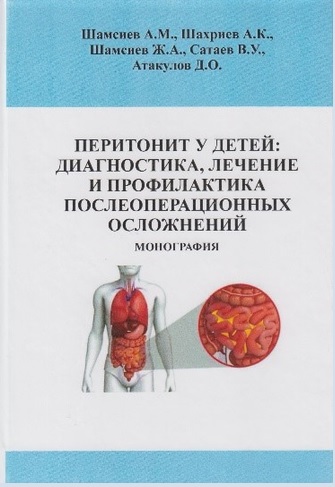 Перитонит у детей: диагностика, лечение и профилактика послеоперационных осложнений