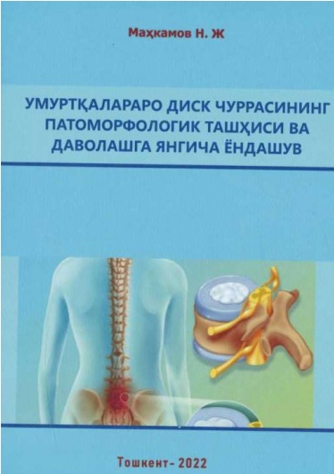 Умуртқалараро  диск чуррасининг патоморфологик ташҳиси ва даволашга янгича ёндашув