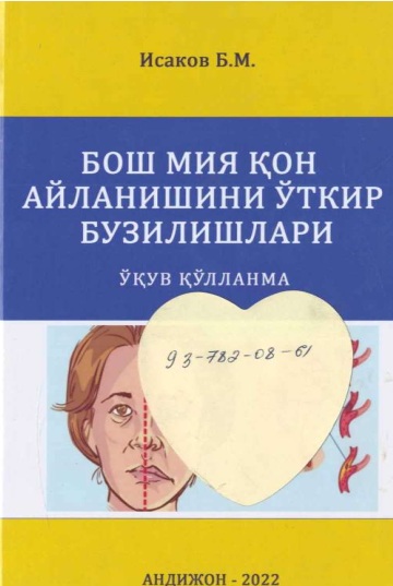 Бош мия қон айланишини ўткир бузилишлари