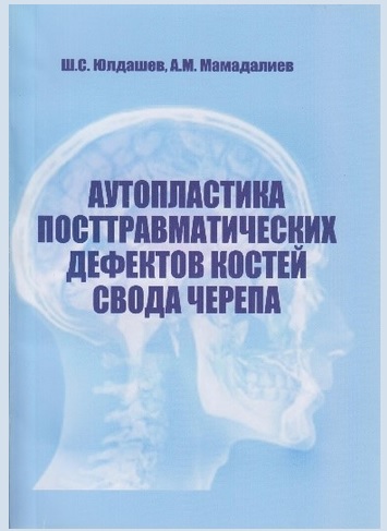 Аутопластика посттравматических дефектов костей свода черепа
