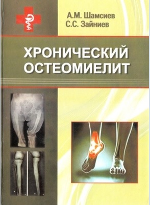 Хронический остеомиелит