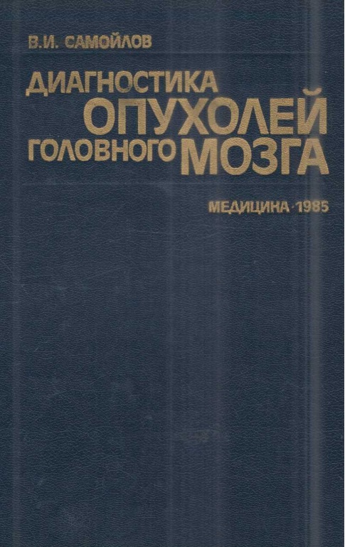 Диагностика опухолей головного мозга
