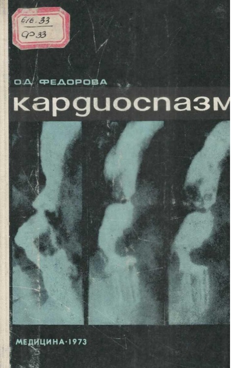 Кардиоспазм