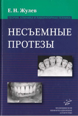 Несьемные протезы