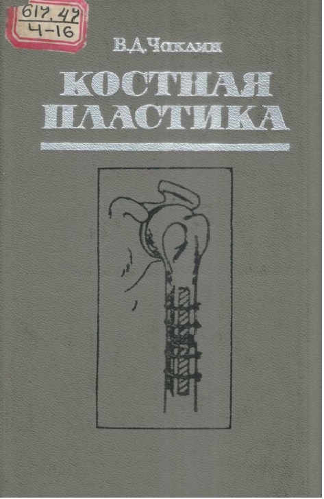 Костная пластика