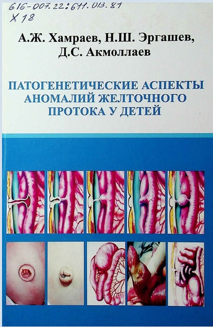 Патогенетические аспекты аномалий желточного протока у детей
