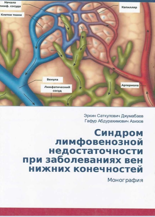 Синдром лимфовенозной недостаточности при заболеваниях вен нижних конечностей