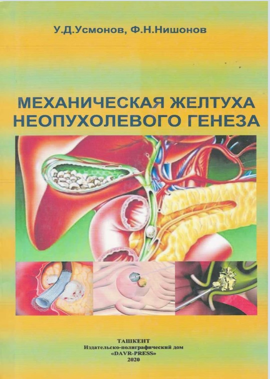 Механическая желтуха неопухолевого генеза