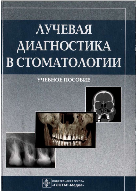 Лучевая диагностика в стоматологии