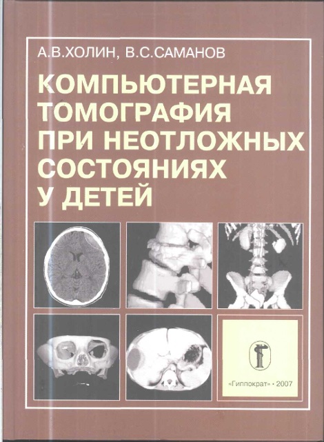 Компьютерная томография при неотложных состояниях у детей