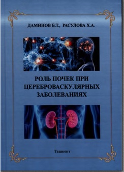 Роль почек при цереброваскулярных заболеваниях