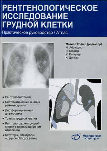 Рентгенологическое исследование грудной клетки