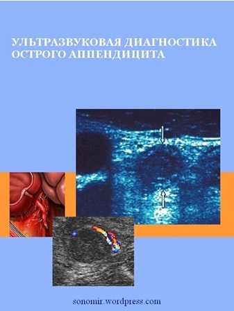 Ультразвуковая диагностика острого аппедицита