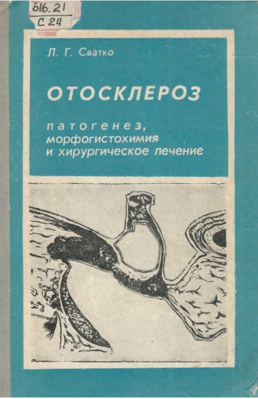Отосклероз патогенез морфогистохимия и хирургическое лечение
