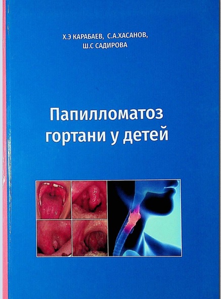 Папилломатоз гортани у детей