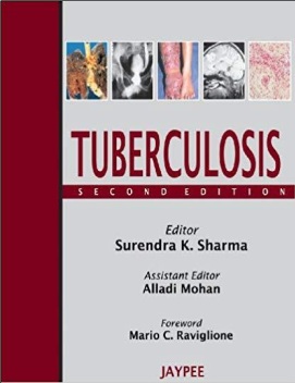 Tuberculosis