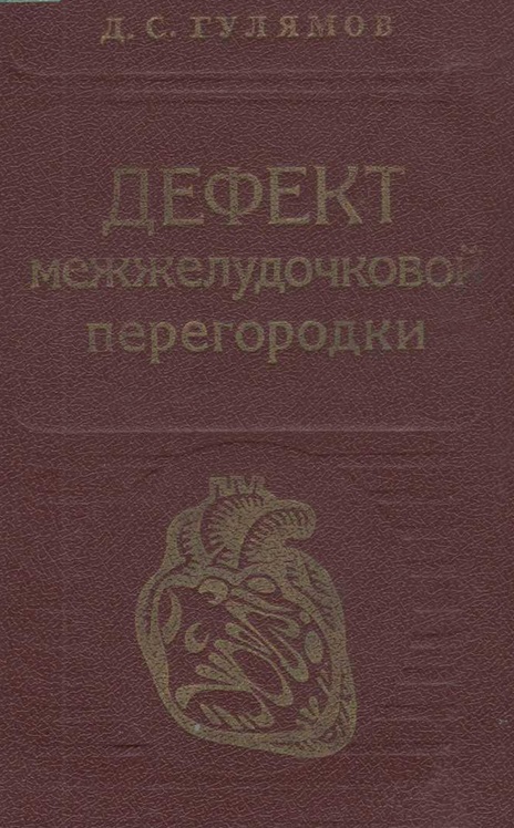 Дефект межжелудочковой перегородки