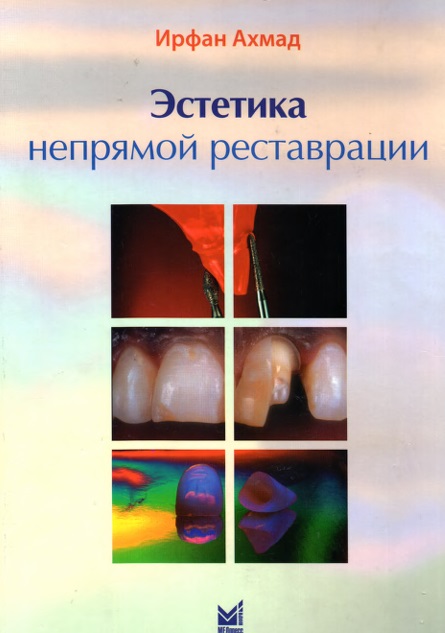 Эстетика непрямой реставрации