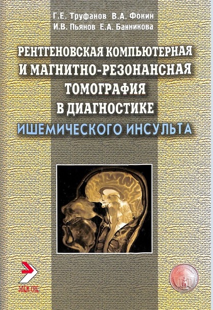 Рентгеновская компьютерная и магнитно-резонансная томография в диагностике ишемического инсульта