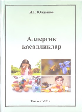 Аллергик касалликлар