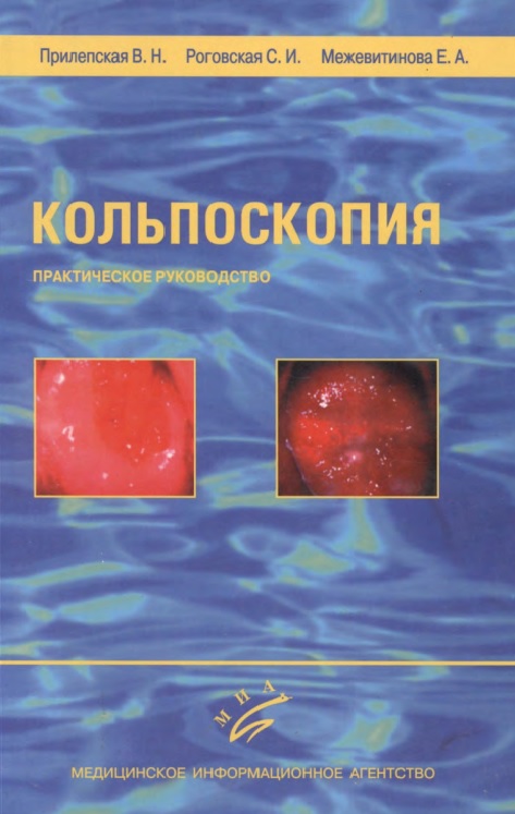 Кольпоскопия