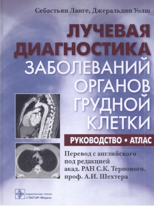 Лучевая диагнотсика заболеваний органов грудной клетки