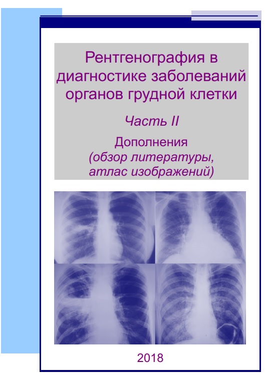 Рентгенография в диагностике заболеваний органов грудной клетки