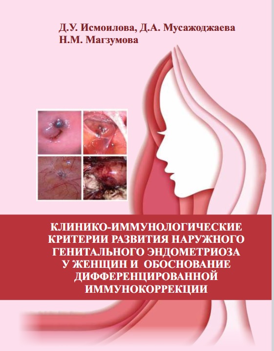Клинико-иммунологические критерии развития наружного генитального эндометриоза у женщин и обоснование дифференцированной иммунокоррекции