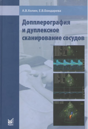 Допплерография и дуплексное сканирование сосудов