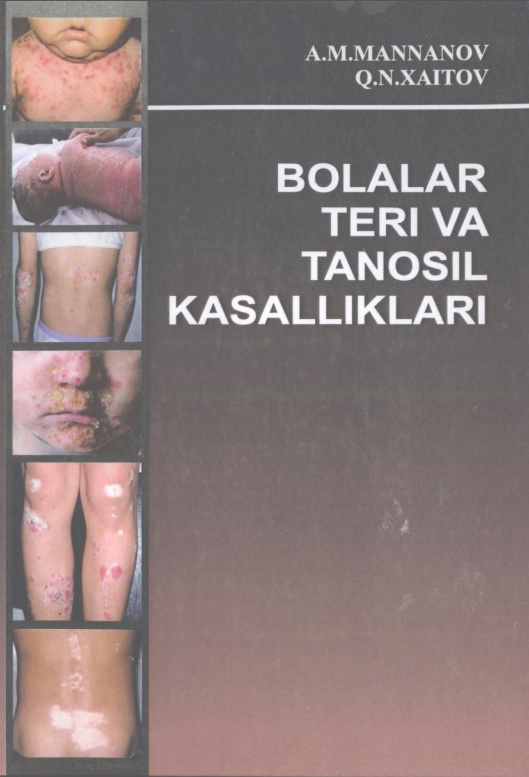 Bolalar teri va anosil kasalliklari
