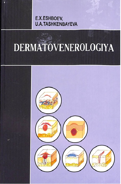 Dermatovenerologiya