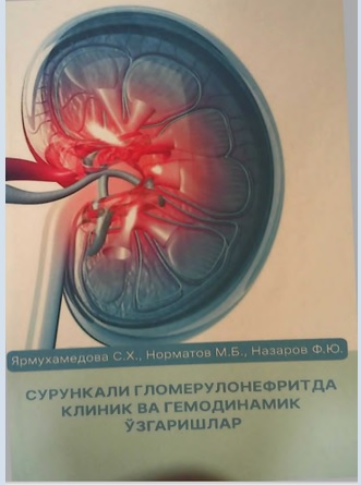Сурункали гломерулонефритда клиник ва гемодинамик ўзгаришлар