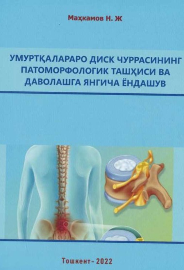 Умуртқаларнинг диск чуррасининг патоморфологик ташҳиси ва даволашга янгича ёндашув