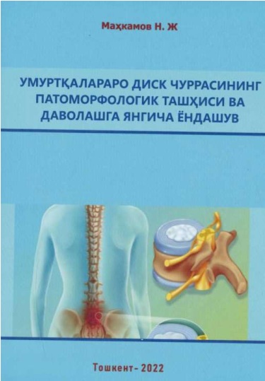 Умуртқалараро диск чуррасининг патоморфологик ташҳиси ва даволвшга янгича ёндашув