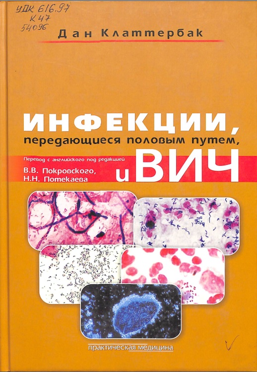 Инфекции, передающиеся половым путем