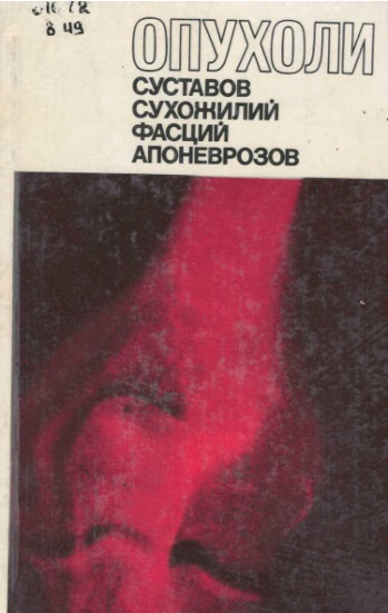 Опухоли суставов, сухожилий, фасций, апоневроз