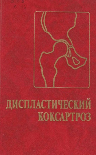 Дисплатический коксартроз
