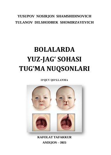 Bolalarda yuz-jag‘ sohasi tug‘ma nuqsonlari
