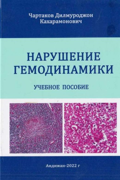 Нарушение гемодинамики