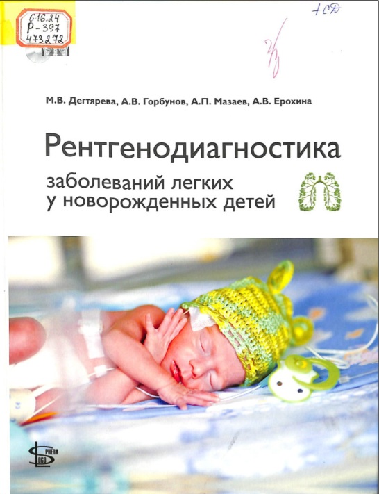 Рентгенодиагностика заболеваний легких у новорожденных