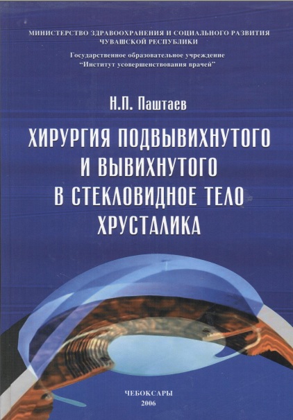 Хирургия под вывихнутого и вывихнутого в стекловидное тело хрусталика