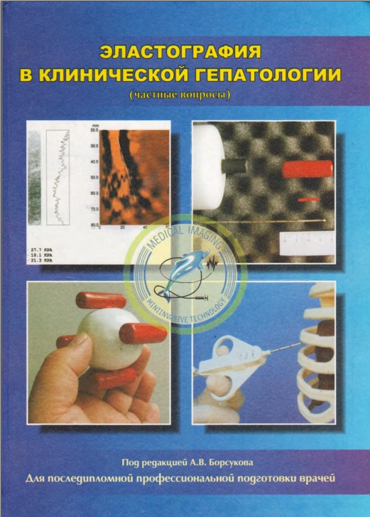 Эластография в клинической гепатологии