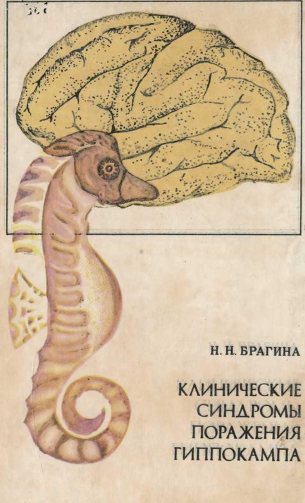 Клинические синдромы поражения гиппокампа