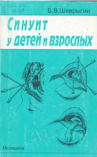 Синуит у детей и взрослых